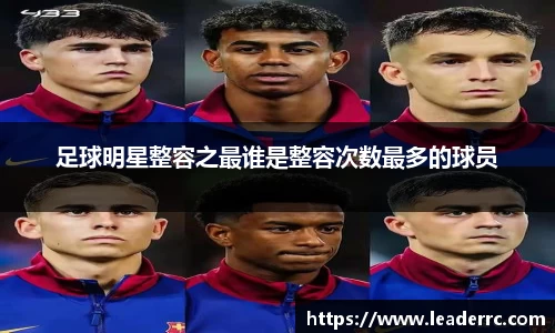 足球明星整容之最谁是整容次数最多的球员